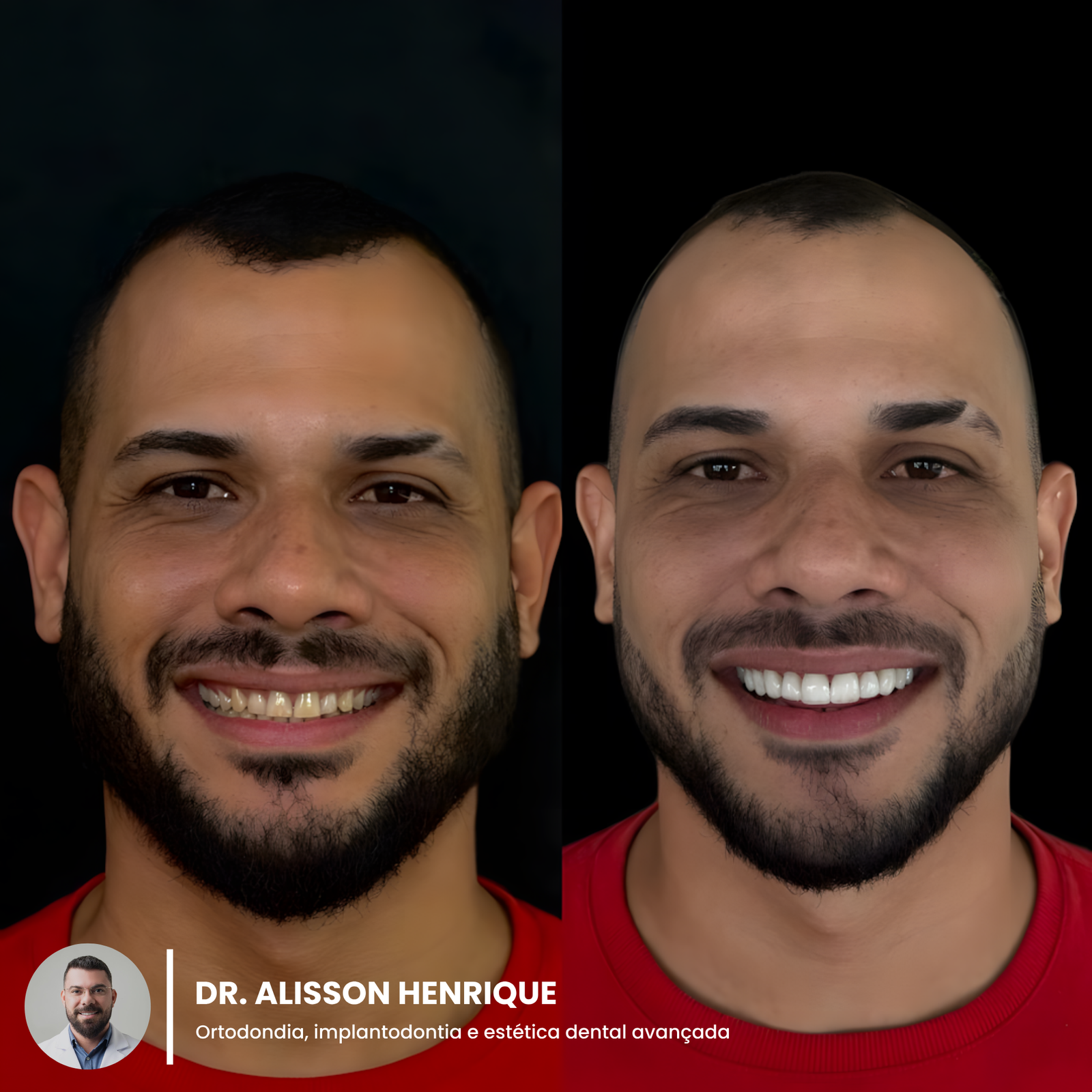 8172176c-af48-44c7-878b-d701cb90455c_upscayl_1x_upscayl-standard-4x