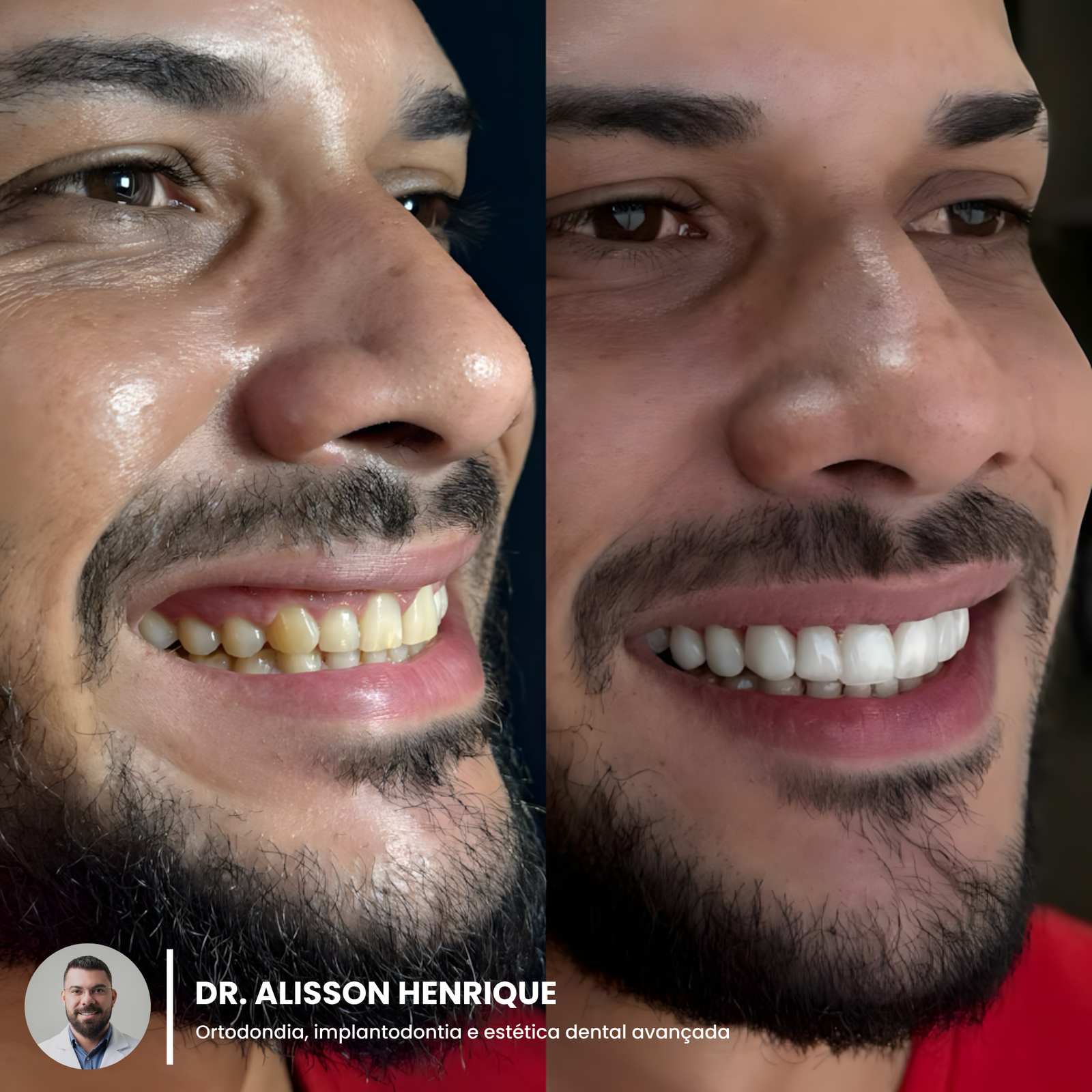 928cf984-30aa-46a3-8294-11ed92175cd6_upscayl_1x_upscayl-standard-4x