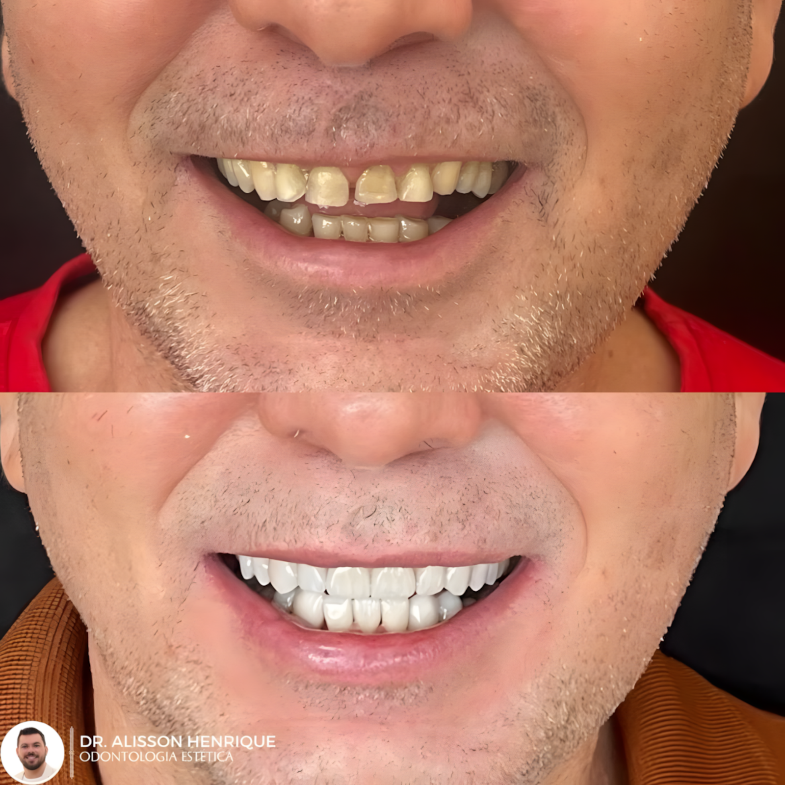 9629ceac-e4a8-489a-bda5-a0cb7ebf2039_upscayl_1x_upscayl-standard-4x