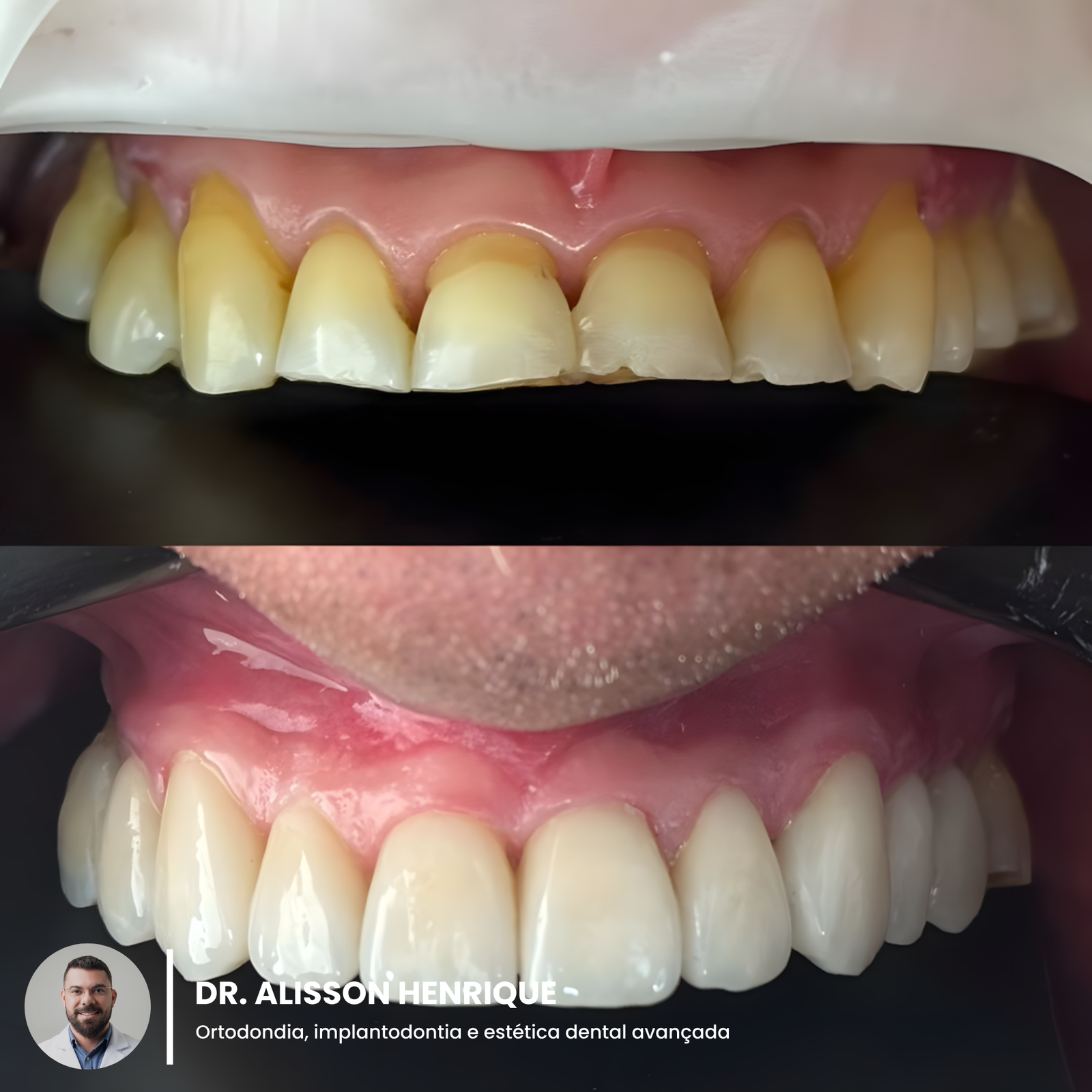 WhatsApp Image 2025-03-29 at 10.38.08_upscayl_1x_upscayl-standard-4x