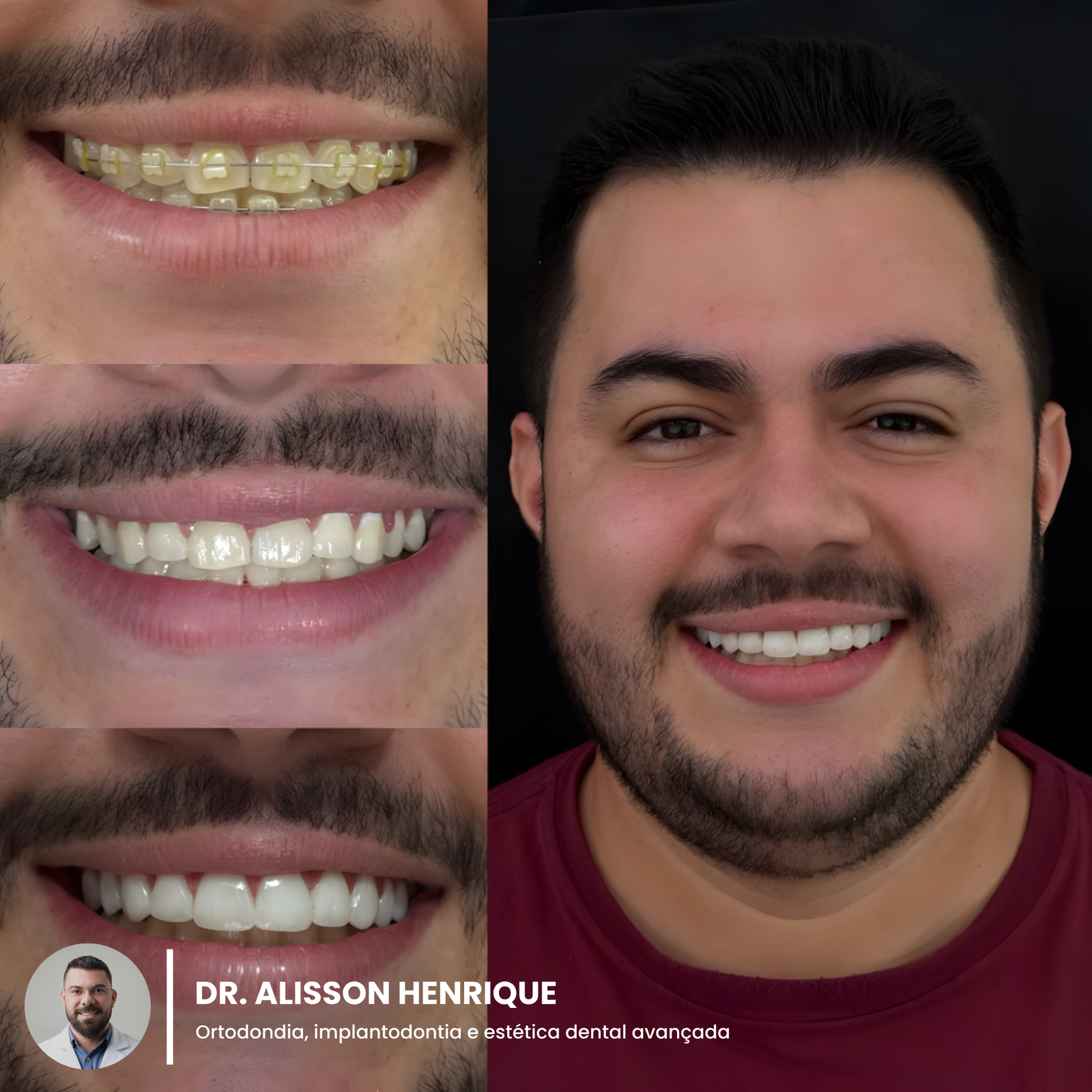 d4ff52f0-9c52-4329-9203-1ba2fd728c61_upscayl_1x_upscayl-standard-4x