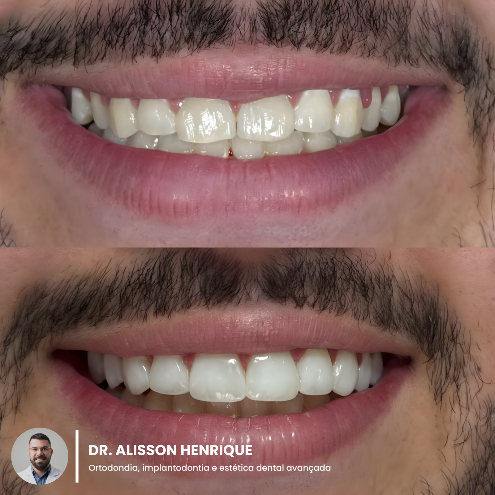 f84e59e4-165d-454e-aacb-d090ecf7a834_upscayl_1x_upscayl-standard-4x